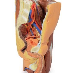 Mannelijk Linker Heup & proximale dij, 3Dprint