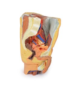 Mannelijk Linker Heup & proximale dij, 3Dprint