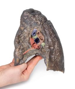 Hilum van de rechter long, 3D Print