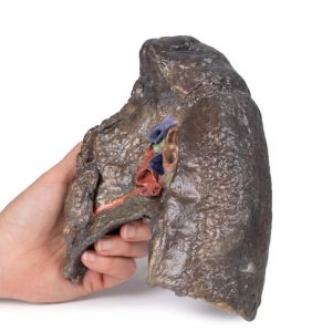 Hilum van de rechter long, 3D Print