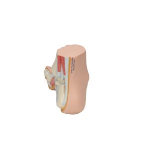 Holvoet (Pes cavus)