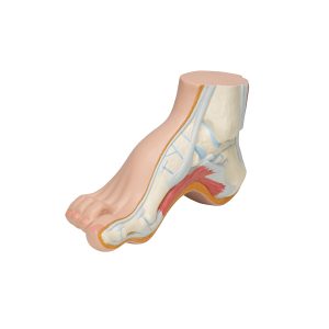Holvoet (Pes cavus)