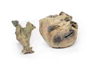 Hydatide Cysten, die het hart en de aorta aantasten, 3D Print