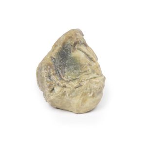 Hydrocele, 3D Print