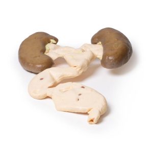 Hydronefrose en Hydro-ureter, 3D Print