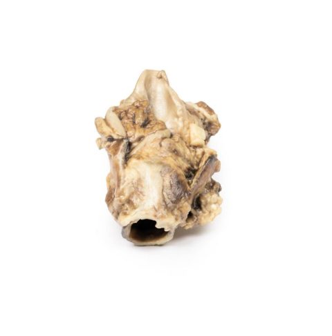 Hypofarynxcarcinoom, 3D Print