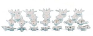 Individuele Wervels (C1 t/m L5)
