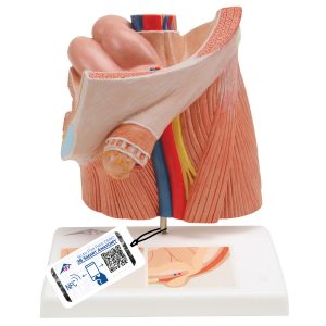 Inguinaal hernia model (liesbreuk)