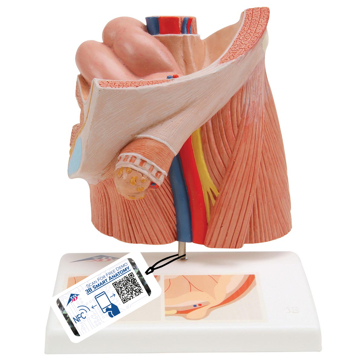Inguinaal hernia model (liesbreuk)
