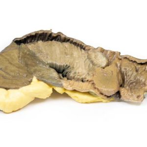 Intussusceptie van Dunne Darm, 3D Print