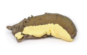 Intussusceptie van Dunne Darm, 3D Print