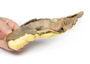 Intussusceptie van Dunne Darm, 3D Print