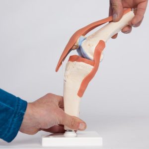 Deluxe functioneel kniegewricht