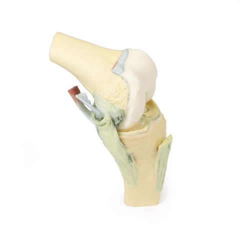 Knie, gebogen, 3Dprint