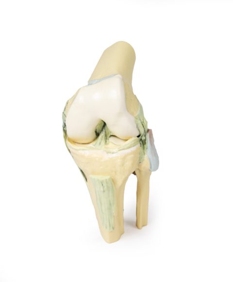 Knie, gebogen, 3Dprint