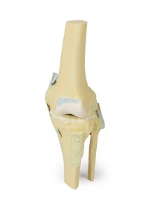 Knie, gebogen, 3Dprint