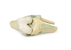 Knie, gebogen, 3Dprint