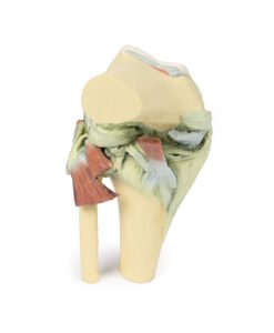 Knie, gebogen, 3Dprint