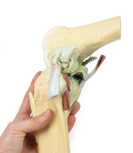 Knie, gebogen, 3Dprint