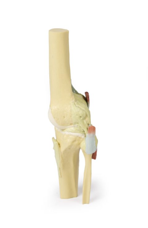 Knie, gestrekt, 3Dprint