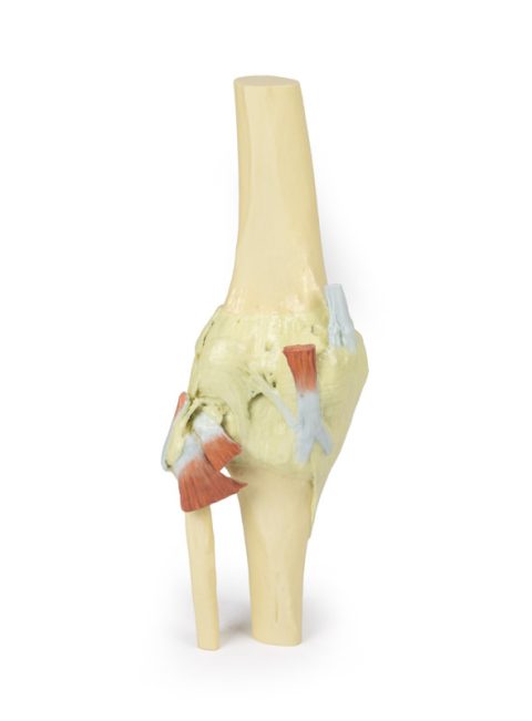Knie, gestrekt, 3Dprint