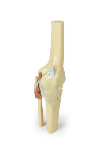 Knie, gestrekt, 3Dprint