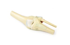 Knie, gestrekt, 3Dprint
