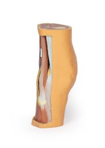 Knieholte, 3D print model