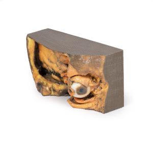 Laterale Oogkas, 3D-Print