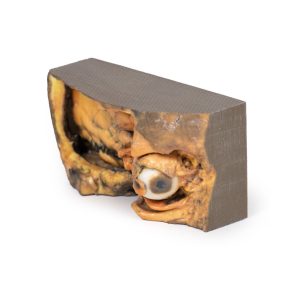 Laterale Oogkas, 3D-Print