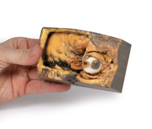 Laterale Oogkas, 3D-Print