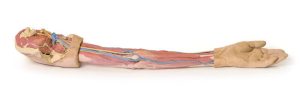 Linker Arm, 3Dprint