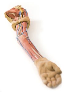 Linker Arm, 3Dprint