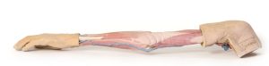 Linker Arm, 3Dprint