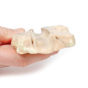 Luchtpijp - Hodgkin Lymfoom, 3D Print