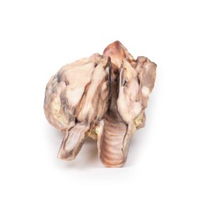Lymfoom in de Schildklier, 3D Print