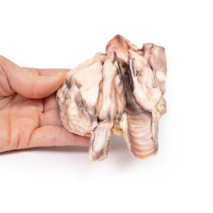Lymfoom in de Schildklier, 3D Print