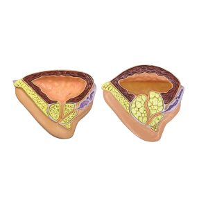 Mannelijk Bekken met BPH