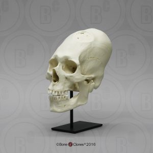 Mannelijk Model Schedelbinding en Trepanatie