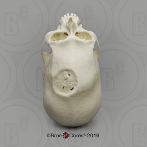 Mannelijk Model Schedelbinding en Trepanatie