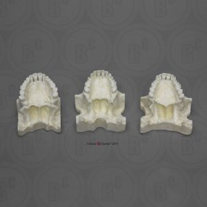 Maxilla Vergelijkingsset
