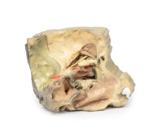 Mediale Oogkas, 3D Print