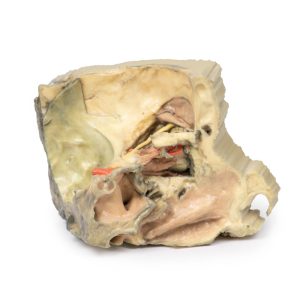 Mediale Oogkas, 3D Print
