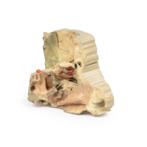 Mediale Oogkas, 3D Print