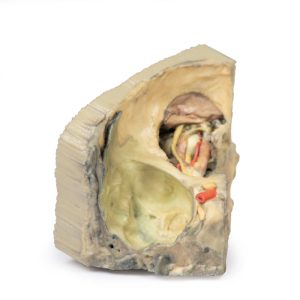 Mediale Oogkas, 3D Print