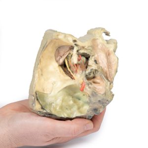 Mediale Oogkas, 3D Print