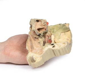 Mediale Oogkas, 3D Print