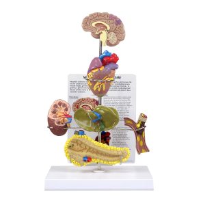 Metabool Syndroom Model