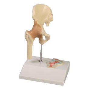 Mini Heupmodel met Dwarsdoorsnede
