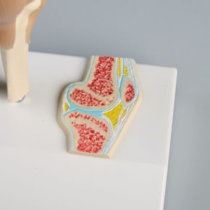 Mini Kniemodel met Dwarsdoorsnede